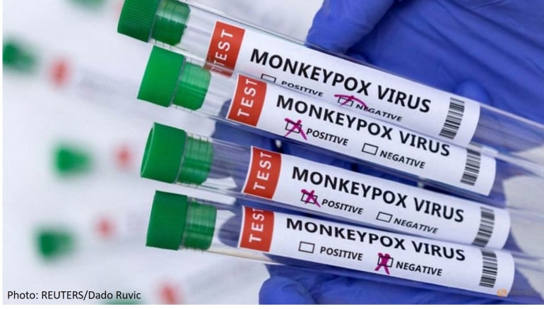 Tabung reaksi berlabel "Virus cacar monyet positif dan negatif" yang diambil pada 23 Mei 2022. (Photo: Reuters/Dado Rovic)